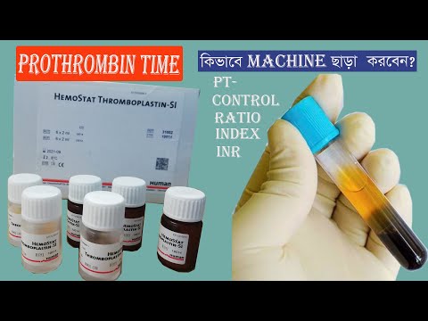 Prothrombin Time Test | PT, INDEX, INR