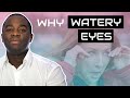 Watery eyes Top 5 causes that are driving you mad