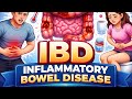 Inflammatory bowel diseases-GIT-CLINICAL-KSIU
