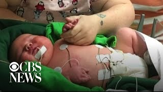 Parents welcome 14 pound, 13 ounce baby in Texas, shattering hospital records