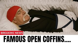 17 Celebrity Open-Casket Funerals That Surprised the World