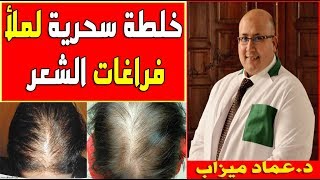 خلطة سحرية لملأ فراغات الشعر من الدكتور عماد ميزاب
