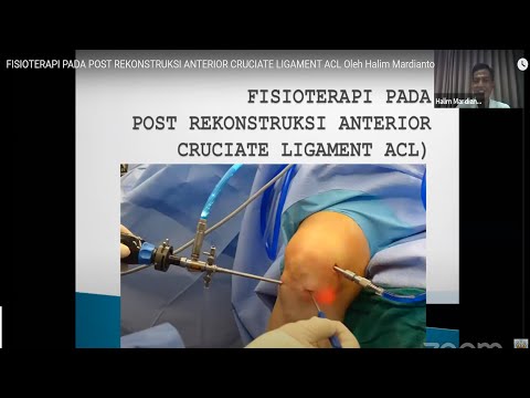 FISIOTERAPI PADA        POST REKONSTRUKSI ANTERIOR CRUCIATE LIGAMENT ACL Oleh Halim Mardianto