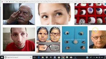 Eye and Ear CPT Guideline Breakdown