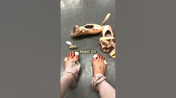 Ballerina Harsh Life 👠