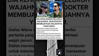 Kisah Dallas Wiens #beritaviral #kisahnyata #kisahinspiratif #faktaunik