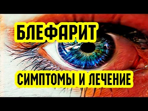 Блефарит: симптомы и лечение. Профилактика блефарита