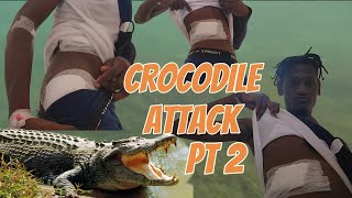 15FT CROCODILE ATTACK LEAVING ME HOSPITALIZED PT 2 ||  LIFE UPDATE