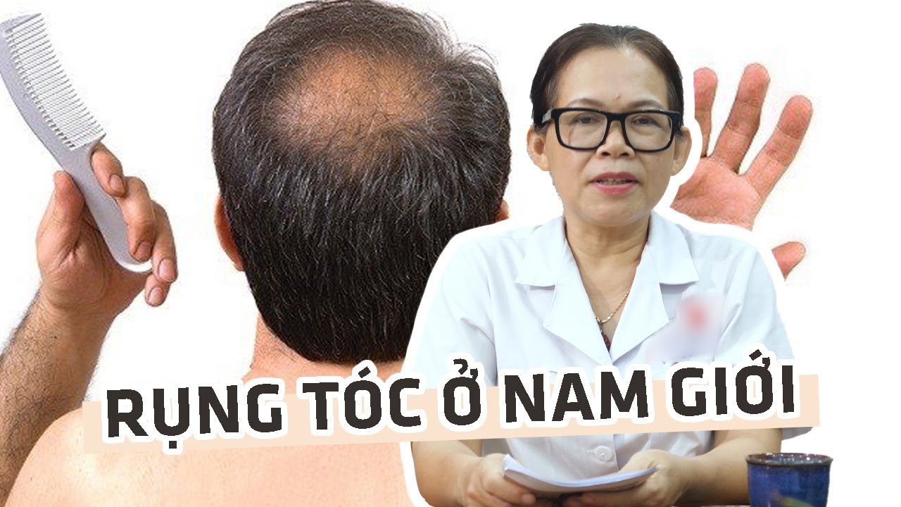 9 NGUYÊN NHÂN RỤNG TÓC NHIỀU CỦA NAM VÀ NỮ