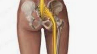 Anatomy of sciatic Nerve,its functions ,roots,branches,disorders ,symptoms & physiotherapy treatment