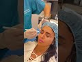 بوتكس لإزالة تجاعيد الجبهة و إعطاء رفعة طبيعية للحواجب بوتكس Botox فيلر تجميل Fillers الكويت