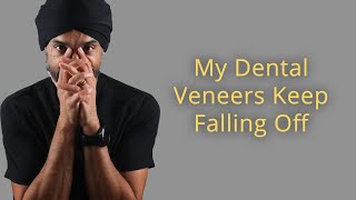 Why My Veneers Kept Falling Off!