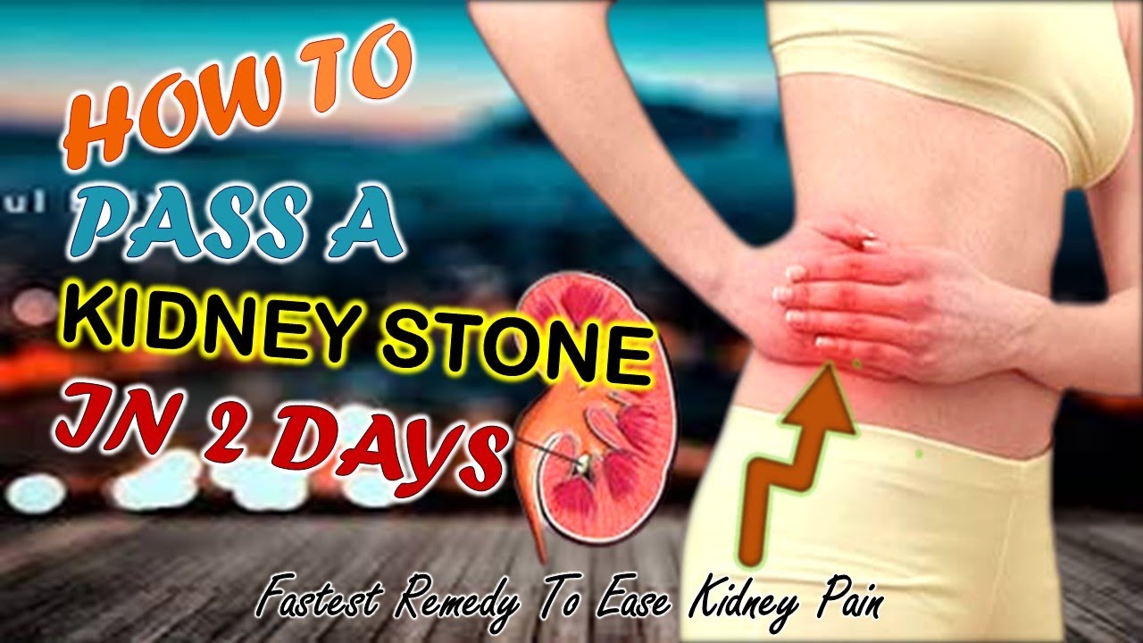 Kidney Stone The Fastest Treatment Of Kidney Pain Get Result In 2