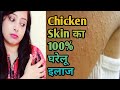 स्किन पर छोटे छोटे से दाने हैं?|Chicken Skin Treatment In Hindi|Keratosis Pilaris treatment hindi