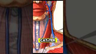 Catéter por vena yugular externa  #emergency