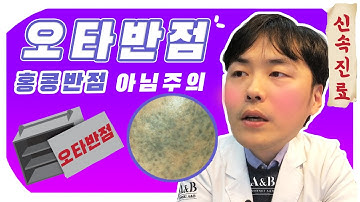 피부의 오타모반 오타반점! 방치할수록 깊어지고 치료하기 어려움 / 연세에이앤비피부과 이해진원장