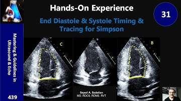 End Diastole & Systole Timing & Tracing for Simpson: hands-on Experience 31