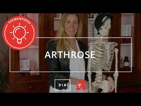 Video: Arthrose: Symptome, Behandlungen Und Ursachen