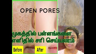 How to close large open pores in tamil ...
