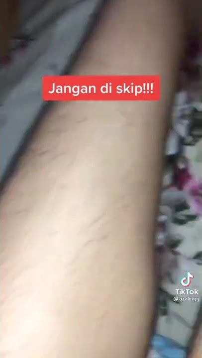 Bulu banyak Gairah sex tinggi