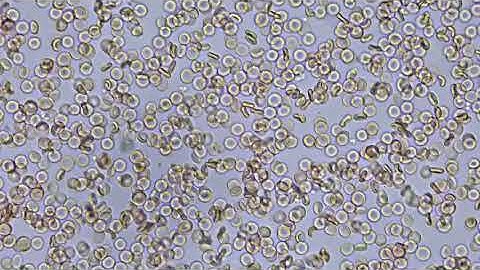 SWIFT microscope stellar1 Red blood cells 40x objective