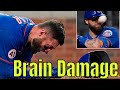 Mlb brain damage