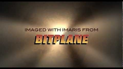 The Astrocyte and the Filament Tracer: The Movie