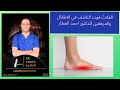 الفلاتْ فوت الناشف في الاطفال والمرهقين