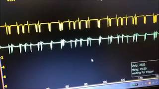 Oscilloscope and Automotive CANbus Visual Communication News