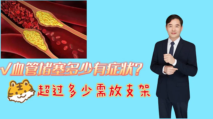 血管狹窄多少會有癥狀？超過多少需要放支架？告訴你答案 - 天天要聞