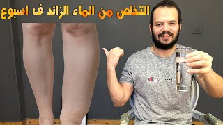 اسباب احتباس الماء فى الجسم || افضل طرق للتخلص من الماء الزائد فى الجسم فى اسبوع