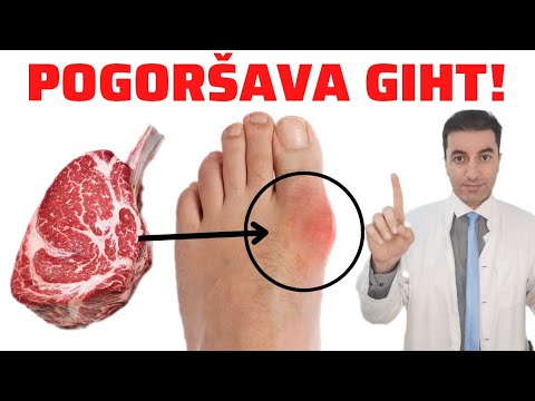 Video: Je li Vaša velika patka u tišini od bolova u zglobovima?