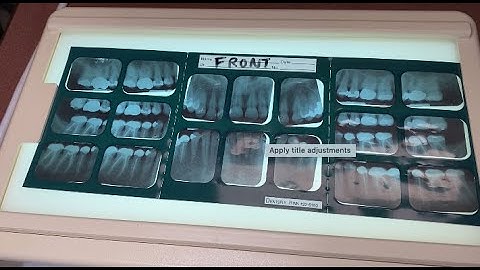 Mount a Traditional FMX (For the purpose of recognizing Dental Anatomy)