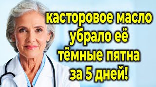 видео: Секрет: Домашняя паста из касторового масла, которая уберет пигментные пятна за ночь! картинка: Секрет: Домашняя паста из касторового масла, которая уберет пигментные пятна за ночь!