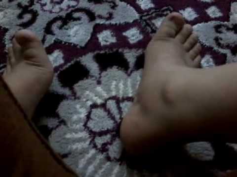 مقاطع مض حك