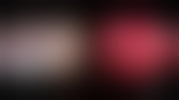 EEA Cavernous Sinus Dermoid Cyst