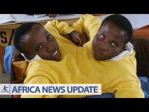 Video: Tanzanian Siamese Twins With One Body For Two Died At The Age Of 21 - Alternative View