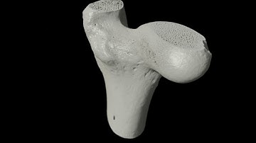 Trabecular and cortical bone revealed by DRAGONFLY