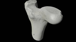 Trabecular and cortical bone revealed by DRAGONFLY