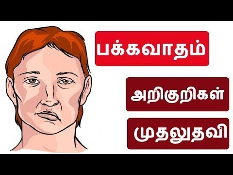 பக கவ தம Stroke Everything You Need To Know Symptoms Cause And Treatments Options Tamil Youtube
