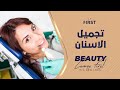 تجميل الاسنان في تركيا DENTAL IMPLANT TURKEY 00905396114484