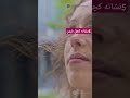 اگه این ۵نشانه رو داری داری جدی بگیر شورت کوته ریزش مو 