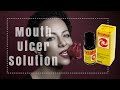 PYRALVEX  Solution Treatment of Mouth Ulcers & Denture Irritation review