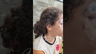 Fungos no cabelo #cabelo #piolho #fungos #cuidadocomcabelo #piolhos