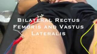Dry Needling Rectus Femoris & Vastus Lateralis