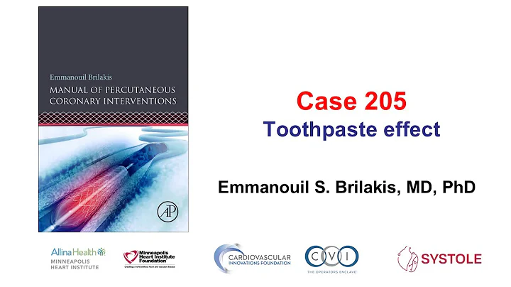Case 205: Manual of PCI - Toothpaste effect