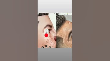 rinku 077 pH photo editor A1 A2 A3 A4 A5 A6 A7 A8 A9 A10