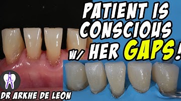 Closing The Patient