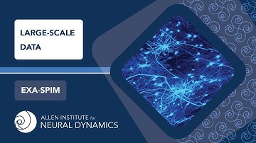 Large-scale Data Handling | Exa-SPIM
