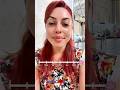 فیلر لب زدم Lipfiller Beauty فیلر لب زدم Lipfiller Beauty